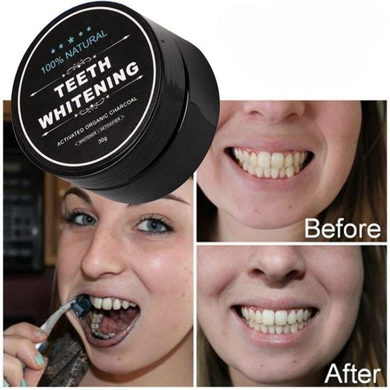1 doos geactiveerd houtskool t - Activated Charcoal Powder recensie en prijs